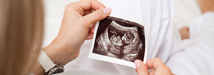 Ultrasound pregnancy scan
